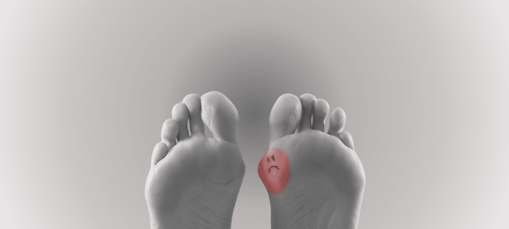 Halluks Valgus