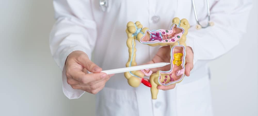 Crohn hastalığı