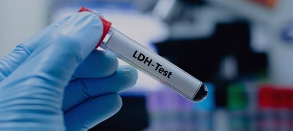 LDH yüksekliği ve düşüklüğü