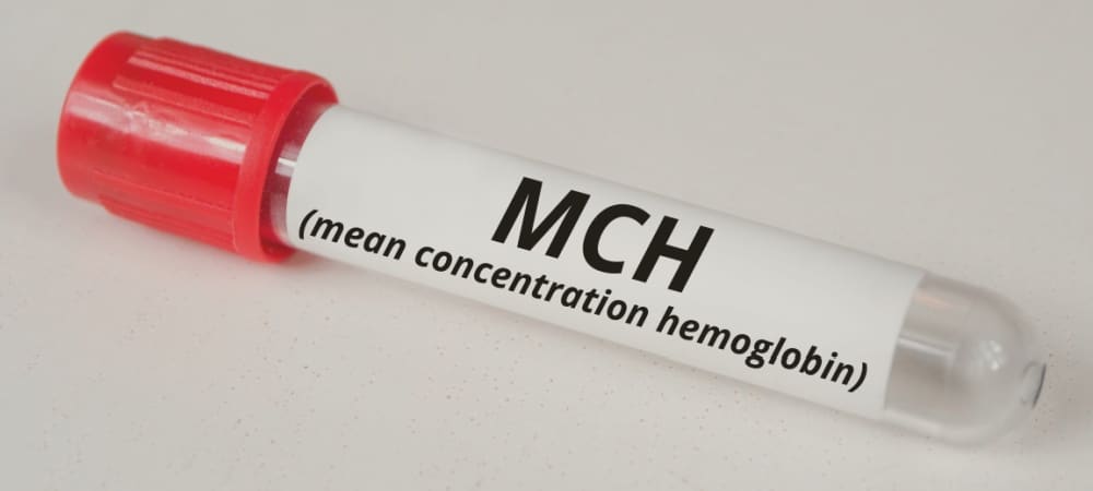 MCH (Ortalama Eritrosit Hemoglobini)