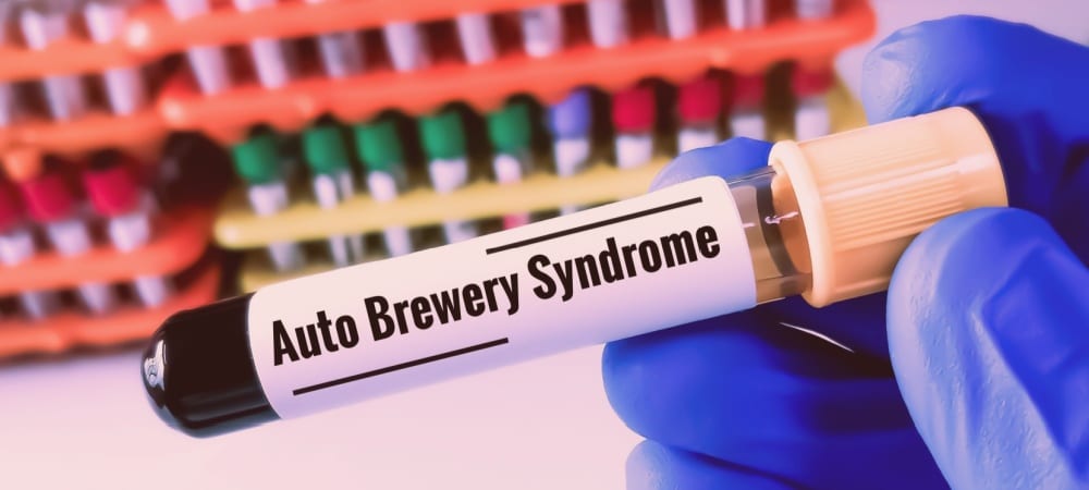 Auto Brewery Sendromu