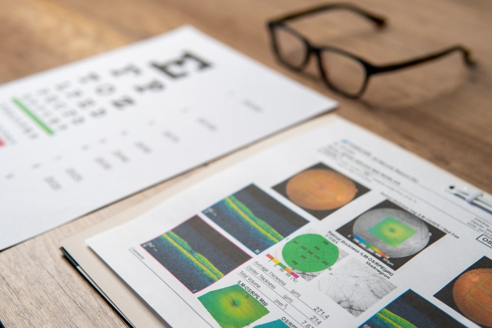 A,Pair,Of,Eyeglasses,And,A,Macular,Report,Including,Eye OCT